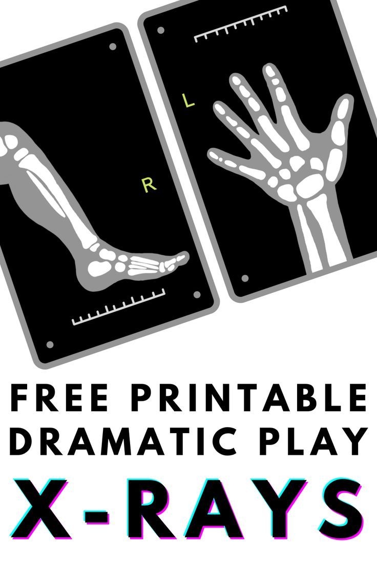 Free Printable X rays For Doctor Themed Dramatic Play