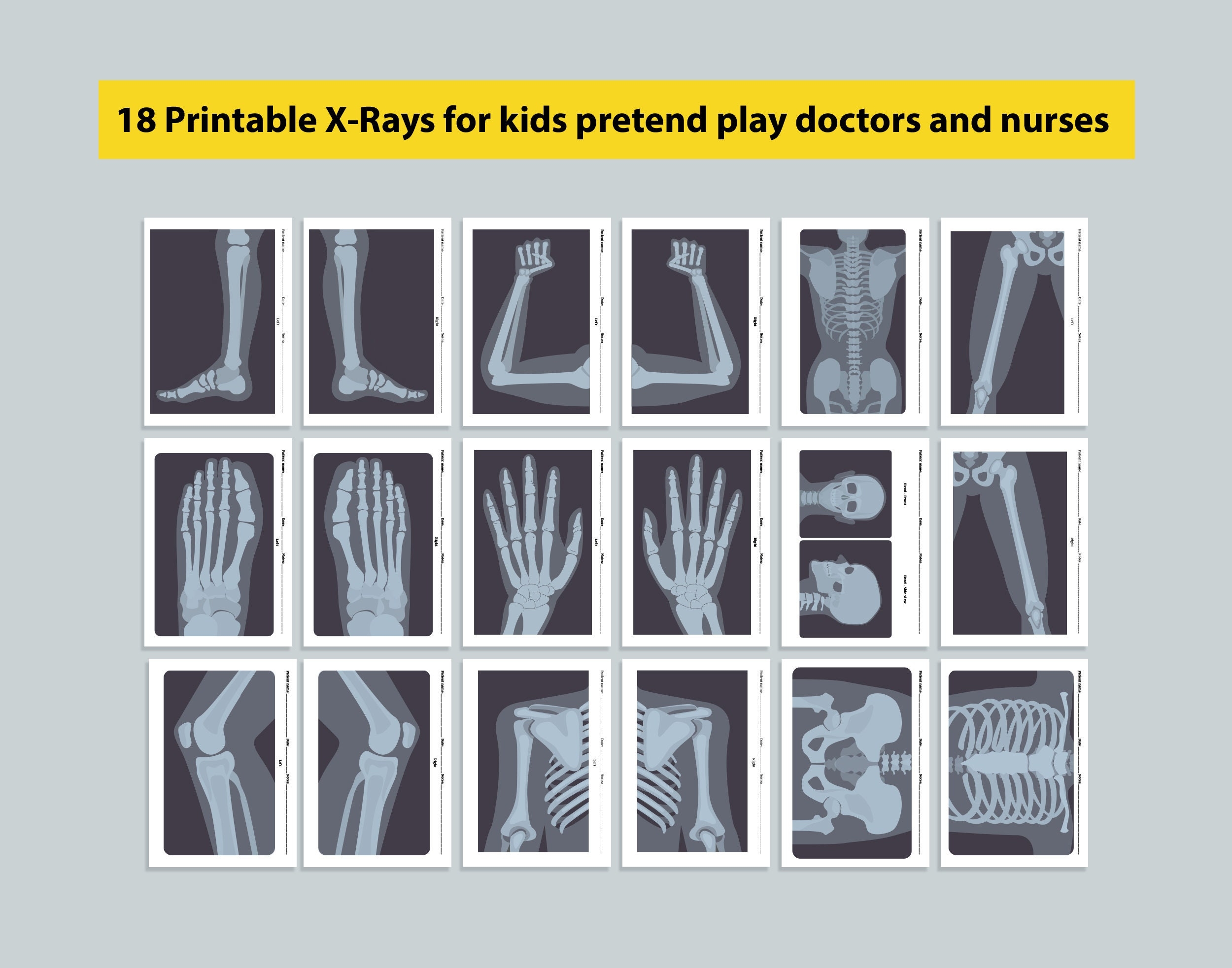 printable x rays for kids