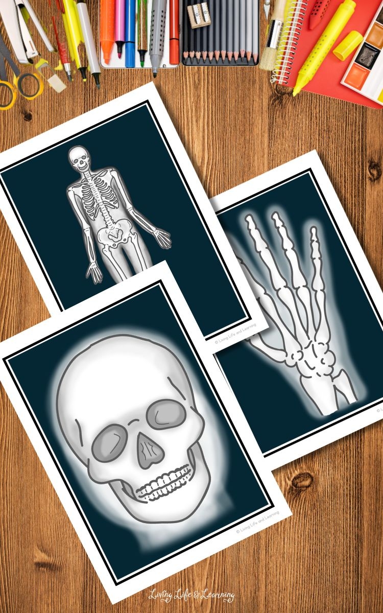 X ray Printables