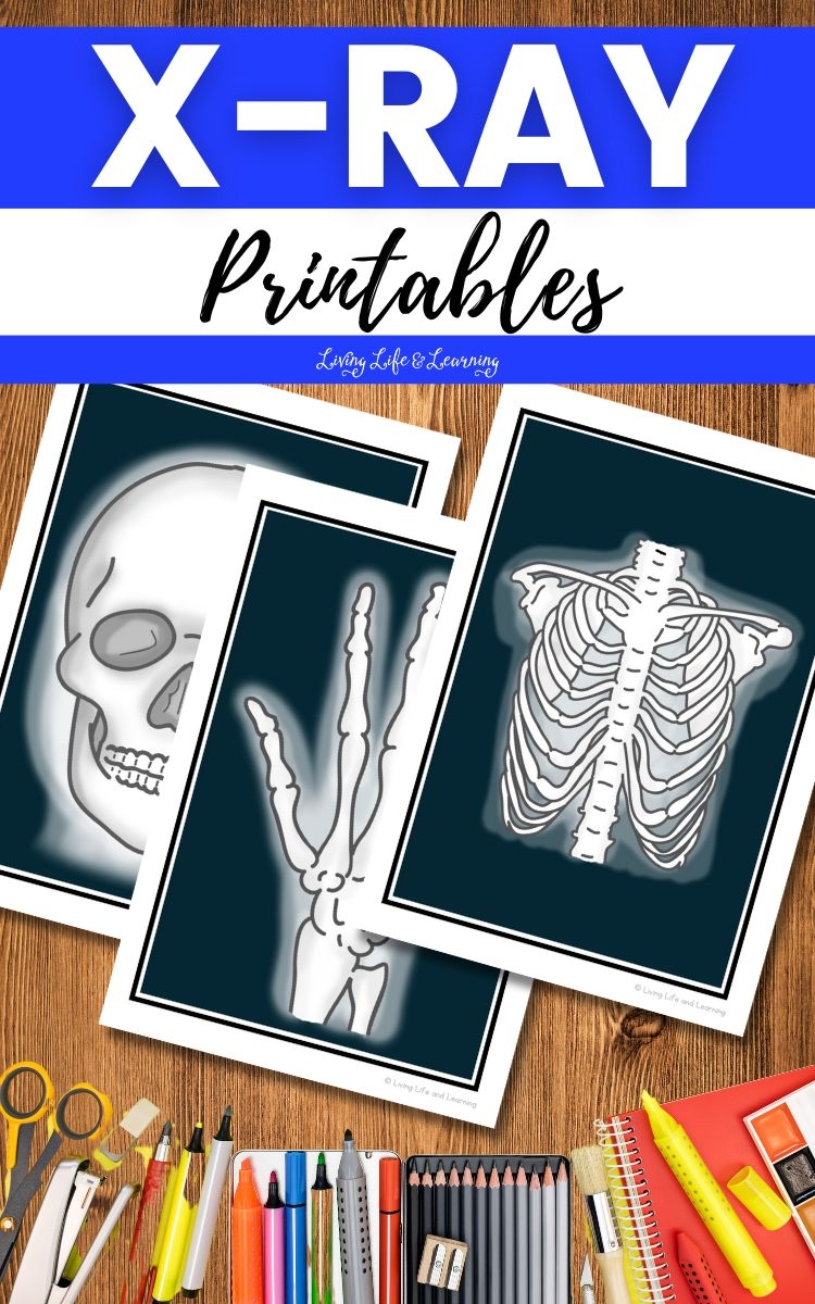 X ray Printables